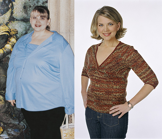 Brooke (Before and After)